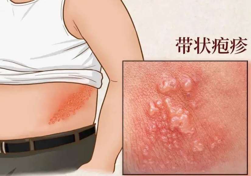 盲目減肥，小心這個(gè)病先找上你！健康防線(xiàn)不可失！